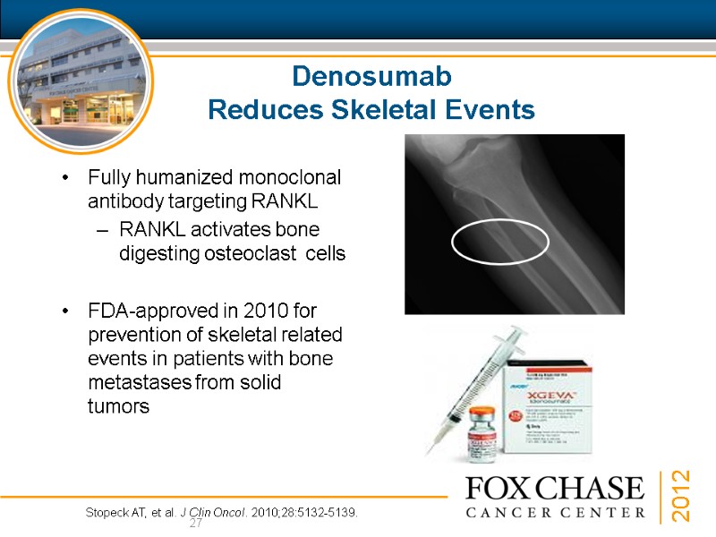 Denosumab  Reduces Skeletal Events Fully humanized monoclonal antibody targeting RANKL RANKL activates bone